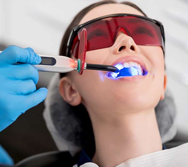 Richmond Professional Teeth Whitening